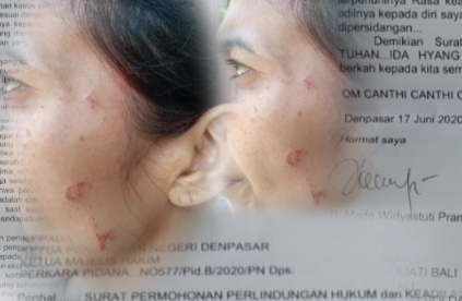 Surat Luka Wanita Bali Minta Keadilan Dianiaya WNA di Tanah Sendiri
